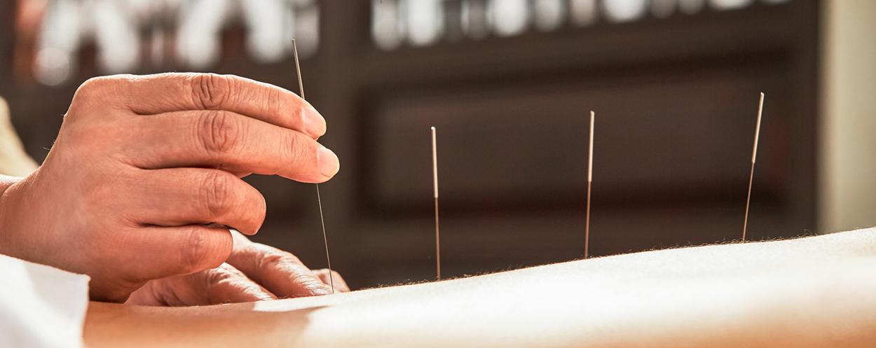 Unleashing the Power of the Needles