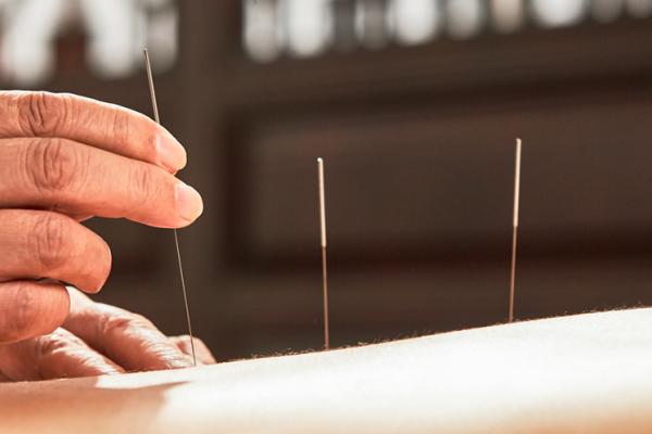 Unleashing the Power of the Needles